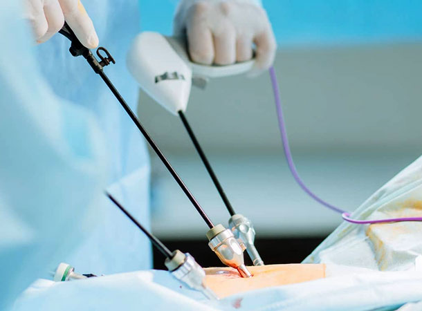 Best Gynaec Laparoscopy Surgeon in Vile Parle, Andheri